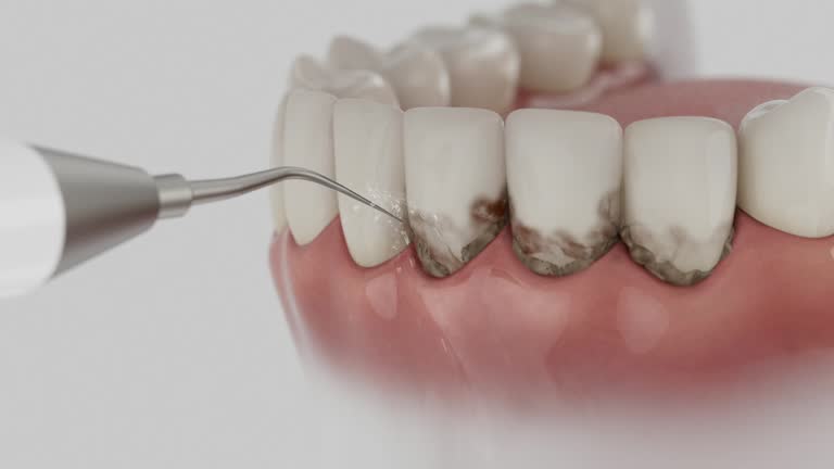 Reliable Dental contractor in North Puyallup, WA by Dentist Open Now
